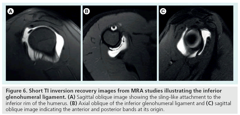 imaging-in-medicine-MRA-studies