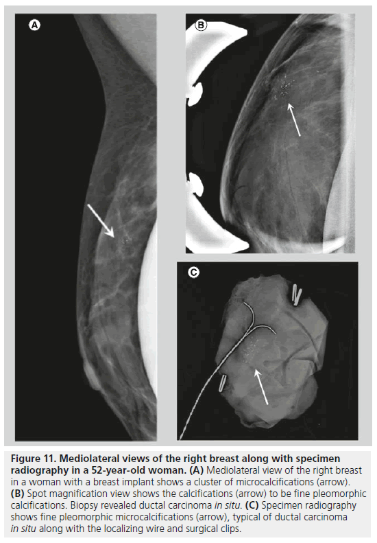 imaging-in-medicine-Mediolateral-view