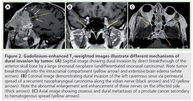 imaging-in-medicine-Sagittal-images