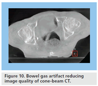 imaging-in-medicine-artifact-reducing