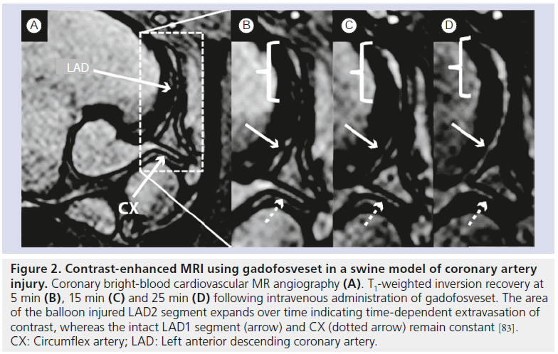 imaging-in-medicine-bright-blood