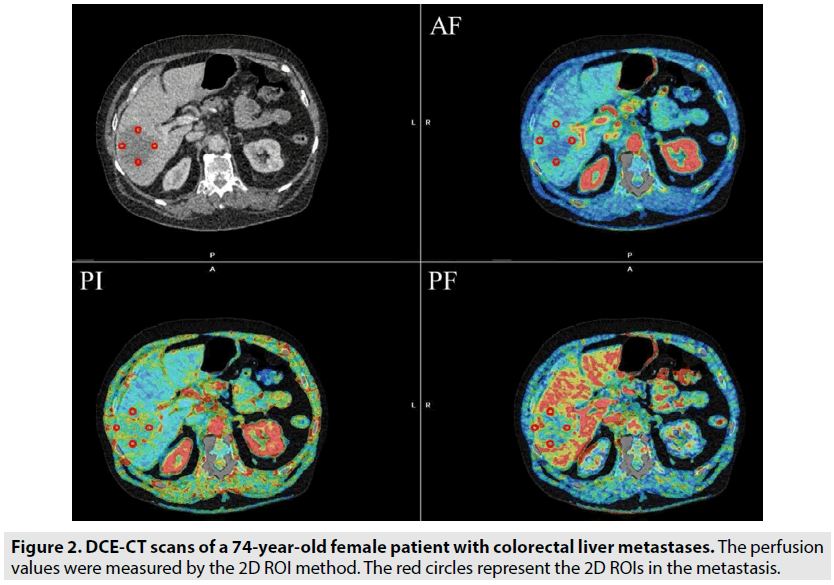 imaging-in-medicine-colorectal-liver