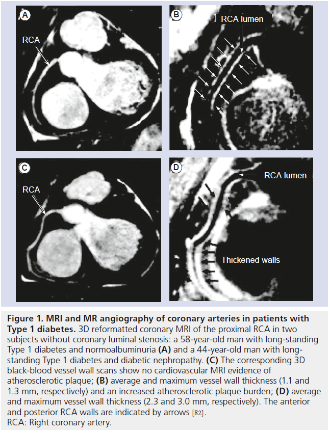 imaging-in-medicine-coronary-arteries