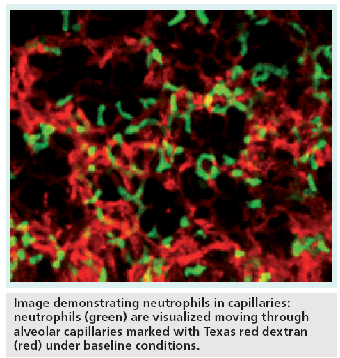 imaging-in-medicine-demonstrating-neutrophils