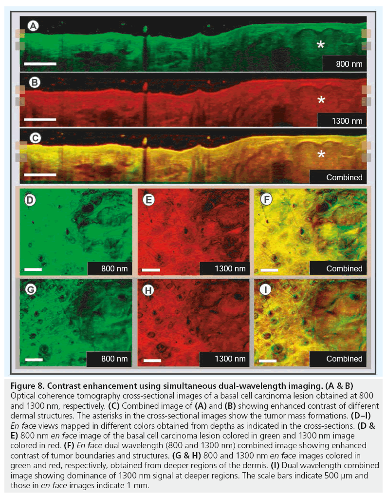 imaging-in-medicine-dual-wavelength