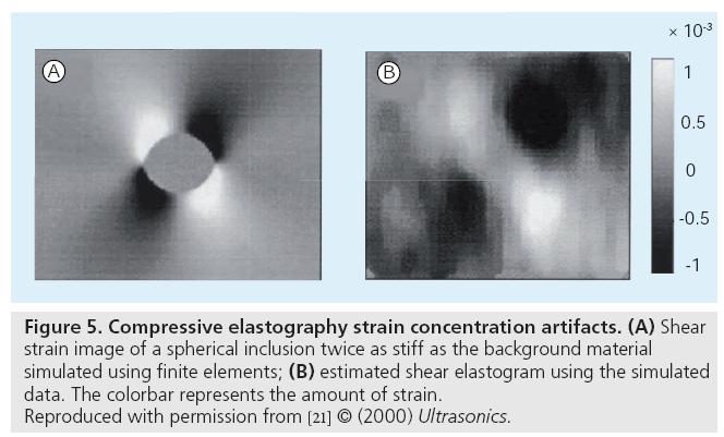 imaging-in-medicine-elastography