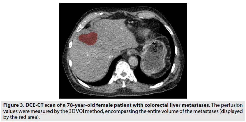 imaging-in-medicine-female-patient