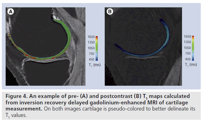 Advanced musculoskeletal MRI at ultra-high field (7 T)