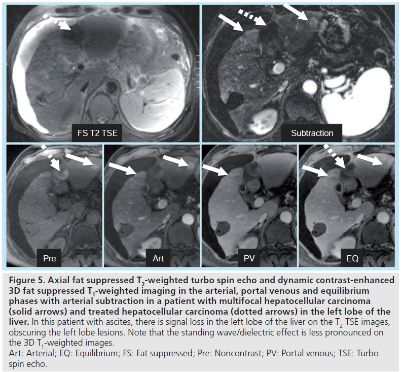 imaging-in-medicine-hepatocellular-carcinoma