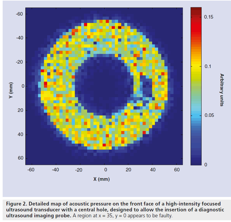 Safety First: Progress In Calibrating High-intensity Focused Ultr