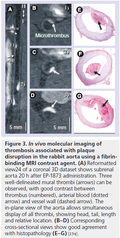 imaging-in-medicine-molecular-imaging