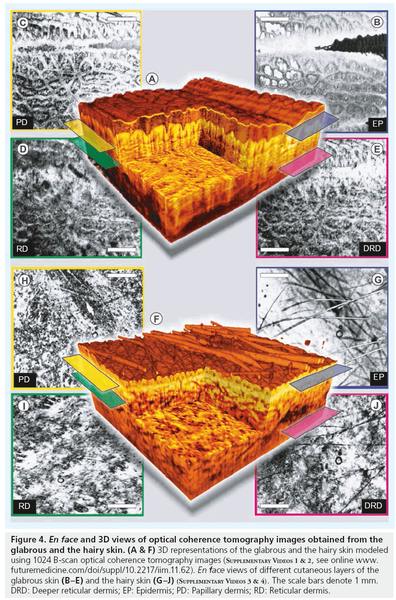 imaging-in-medicine-optical-coherence