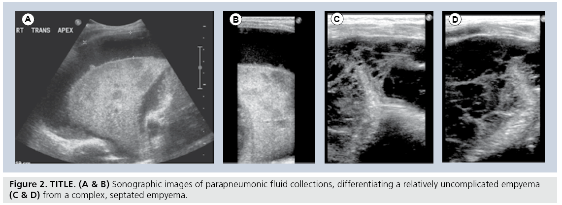 Contemporary Imaging Of The Pediatric Chest