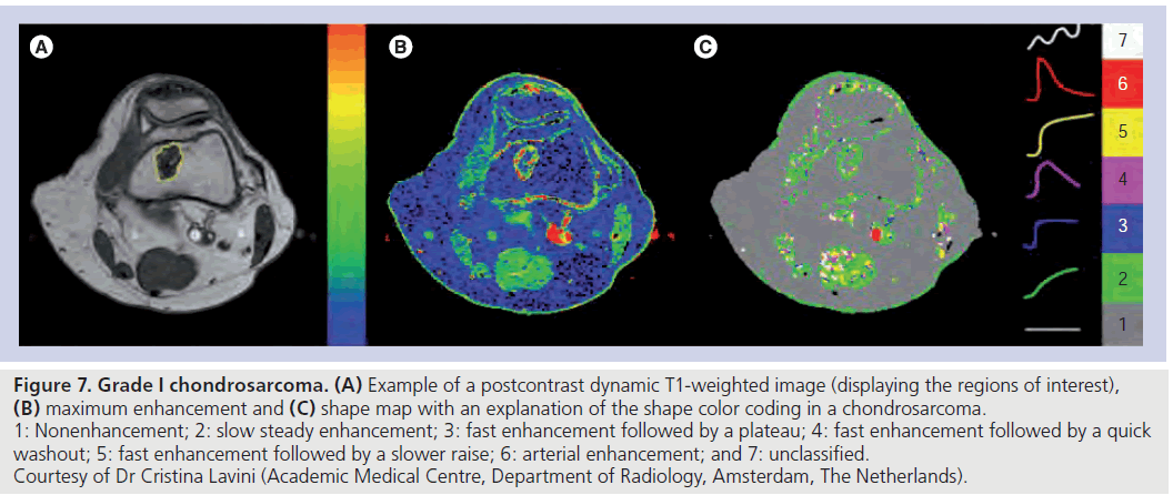 imaging-in-medicine-postcontrast-dynamic