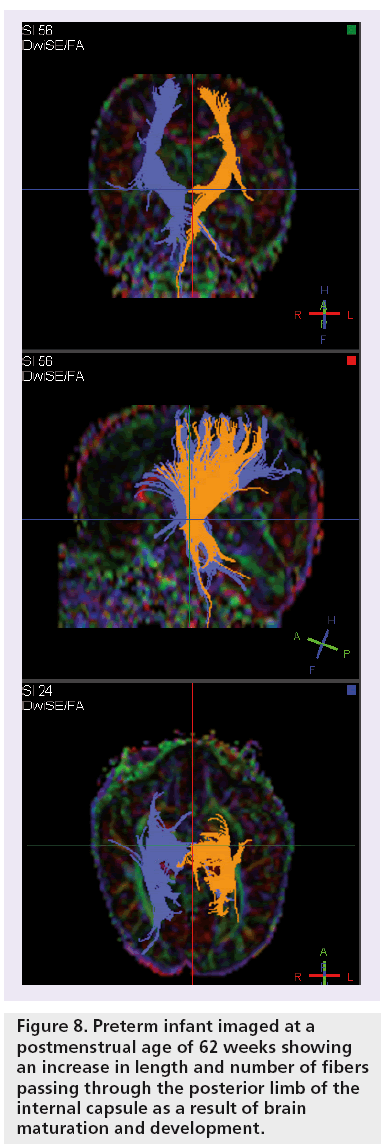 imaging-in-medicine-posterior-limb