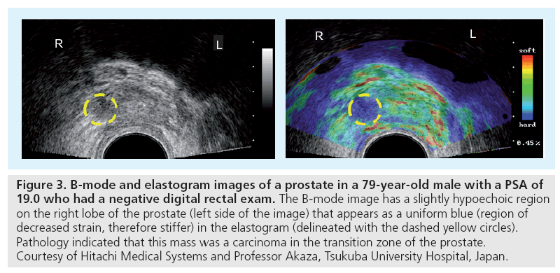 imaging-in-medicine-rectal-exam