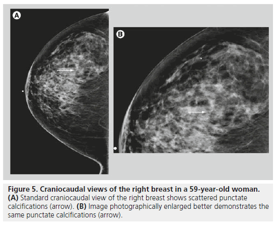 imaging-in-medicine-right-breast