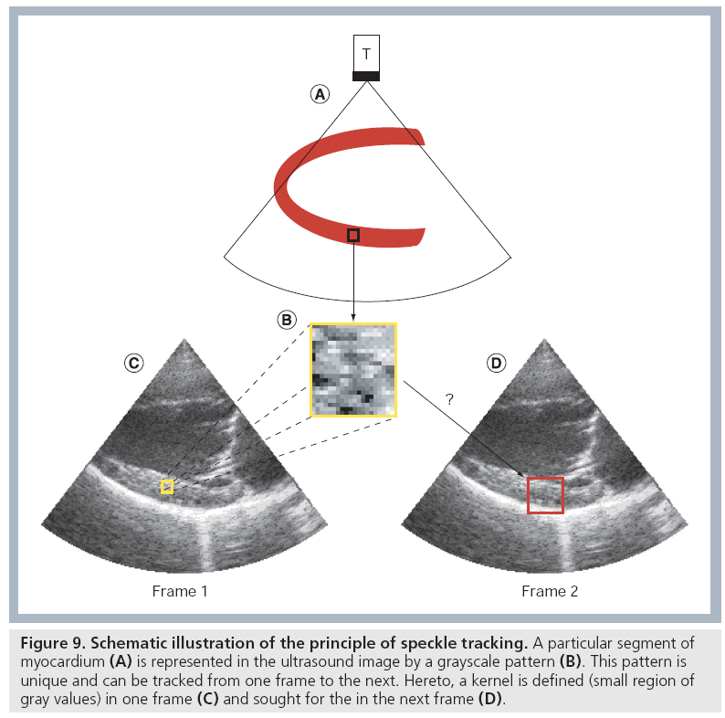 Layer‐specific strain echocardiography may reflect regional
