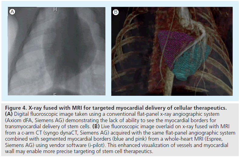 imaging-in-medicine-targeted-myocardial