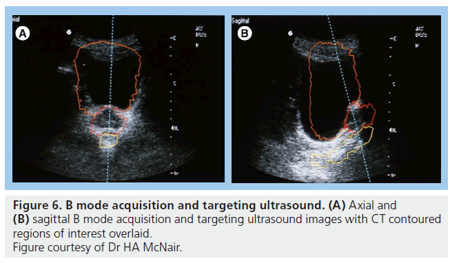 imaging-in-medicine-targeting-ultrasound