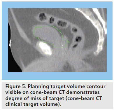 imaging-in-medicine-target–volume