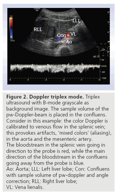 Transabdominal ultrasonography of the pancreas: basic and new asp