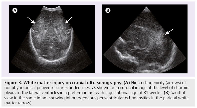 imaging-in-medicine-ultrasonography