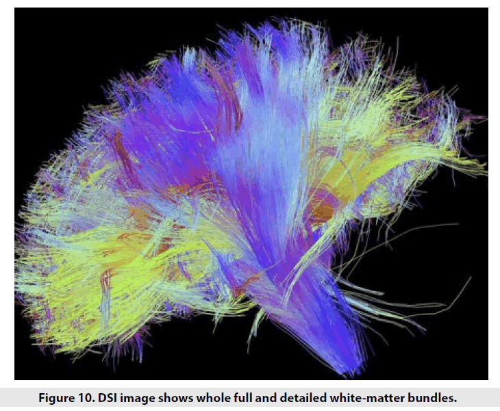 imaging-in-medicine-white-matter