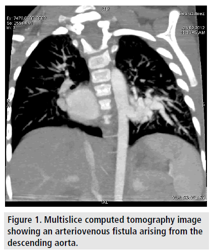 imaging-in-medicine-computed-tomography