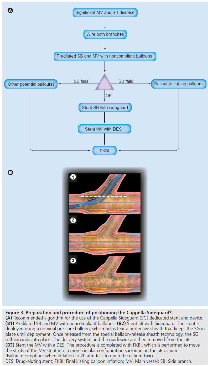 interventional-cardiology-Cappella