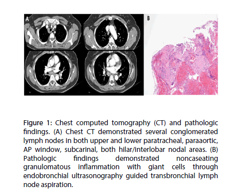 interventional-cardiology-Chest-computed