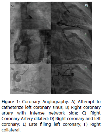 interventional-cardiology-Coronary-Angiography