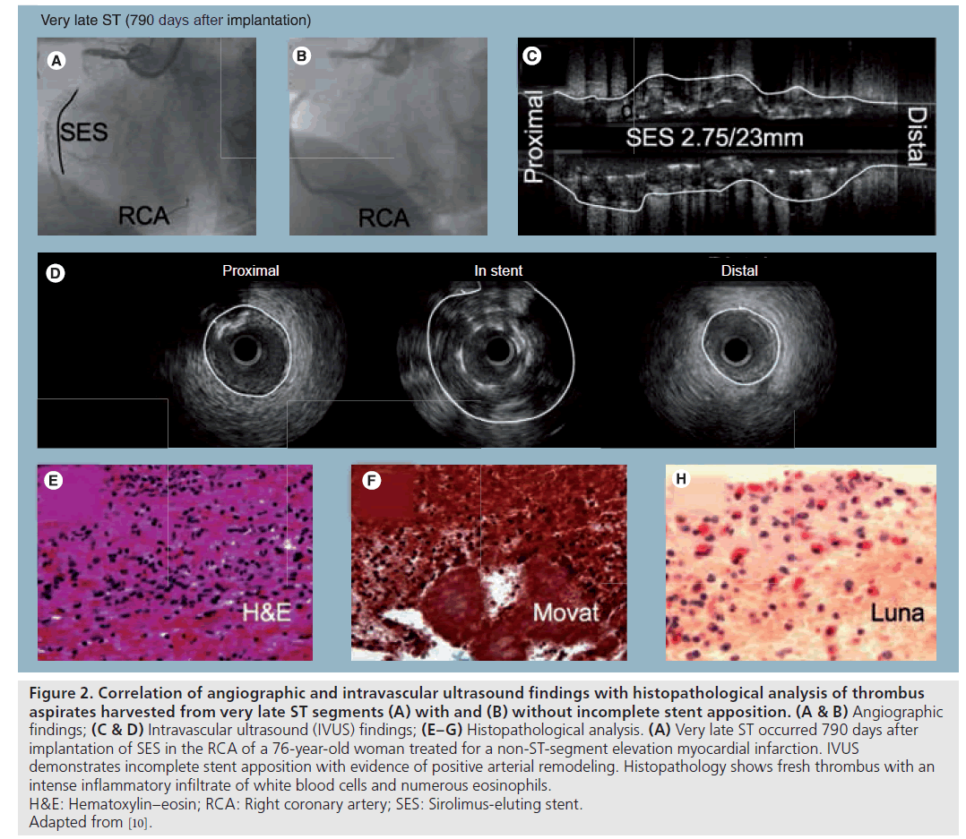 interventional-cardiology-Correlation-angiographic