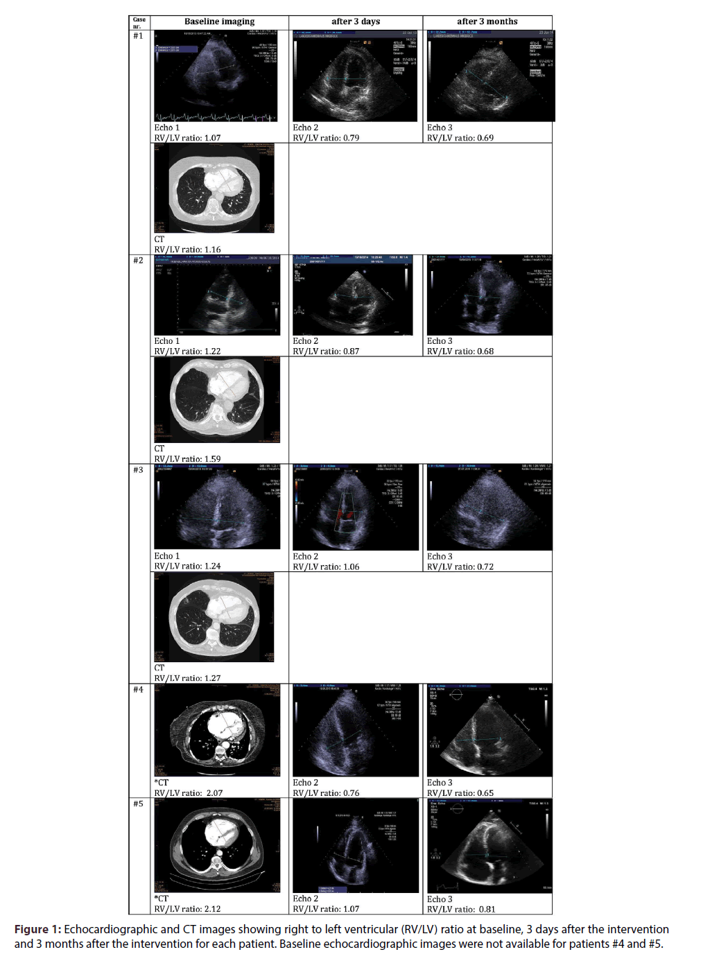 interventional-cardiology-Echocardiographic