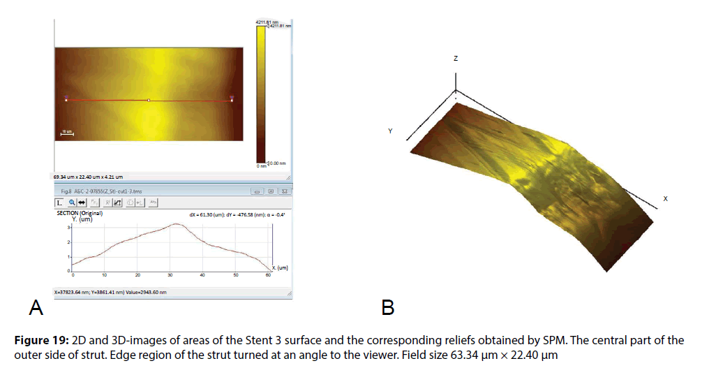 interventional-cardiology-Edge-region