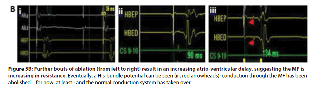 interventional-cardiology-Further-bouts