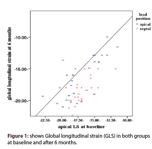 interventional-cardiology-Global-longitudinal-strain