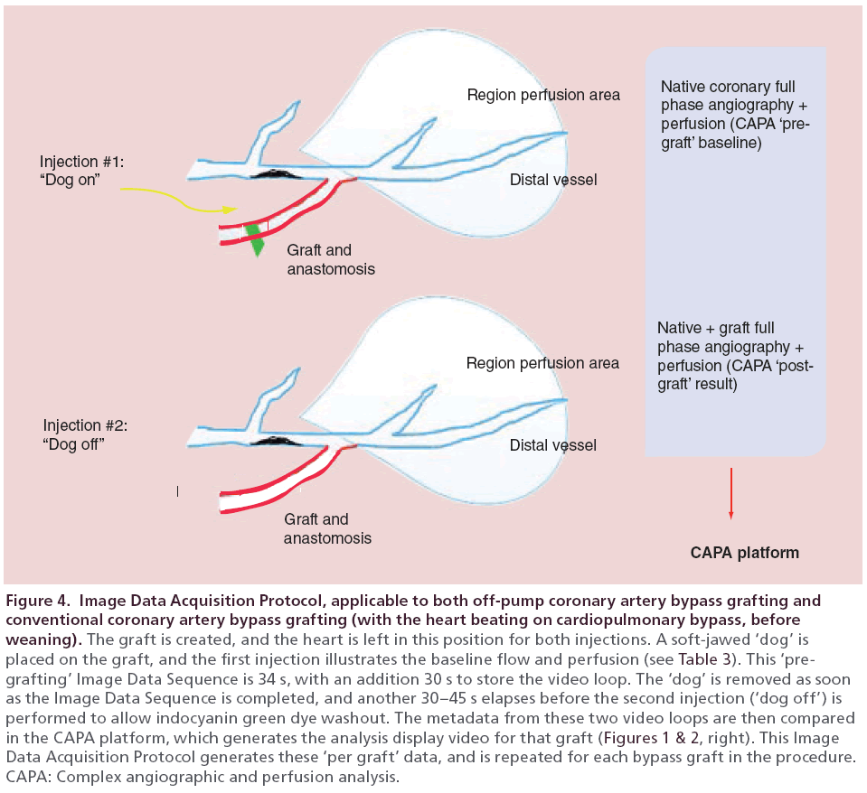 interventional-cardiology-Image-Data-Acquisition