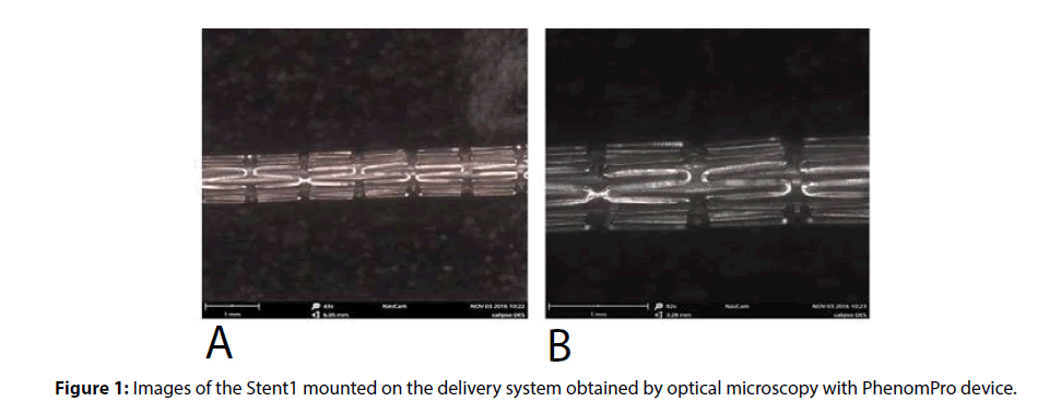 interventional-cardiology-Images-Stent