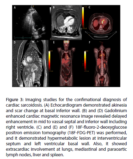 interventional-cardiology-Imaging-studies