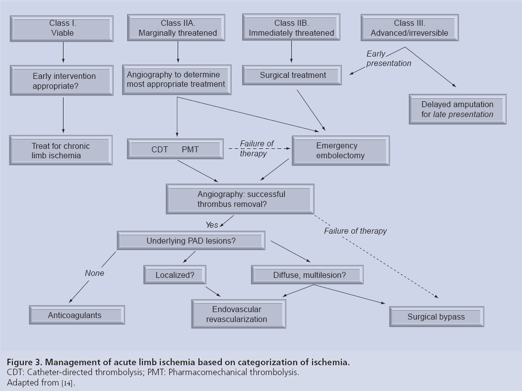 Choosing The Correct Therapeutic Option For Acute Limb Ischemia