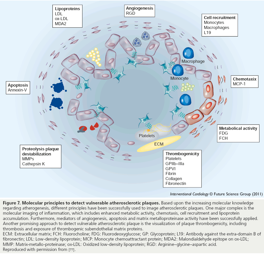 interventional-cardiology-Molecular-principles-detect