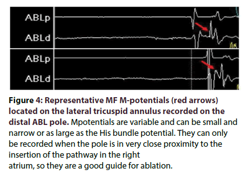 interventional-cardiology-Representative-MF