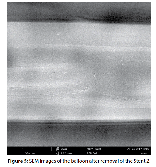 interventional-cardiology-SEM-images