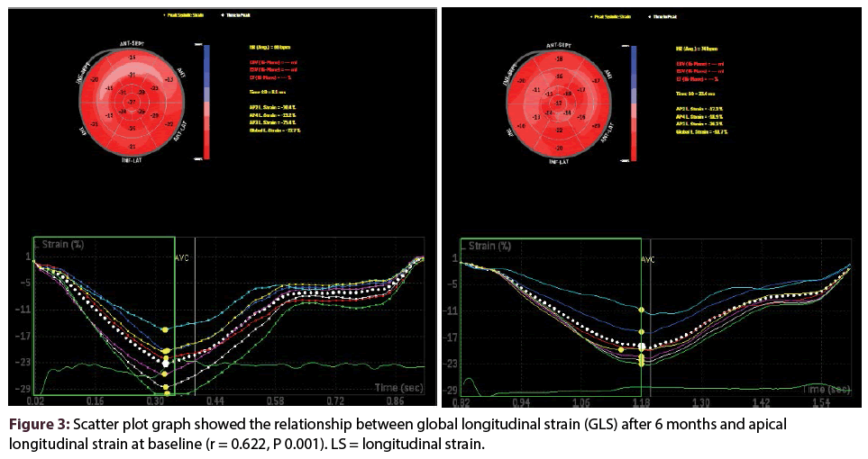 Abnormal left ventricular global longitudinal strain by speckle
