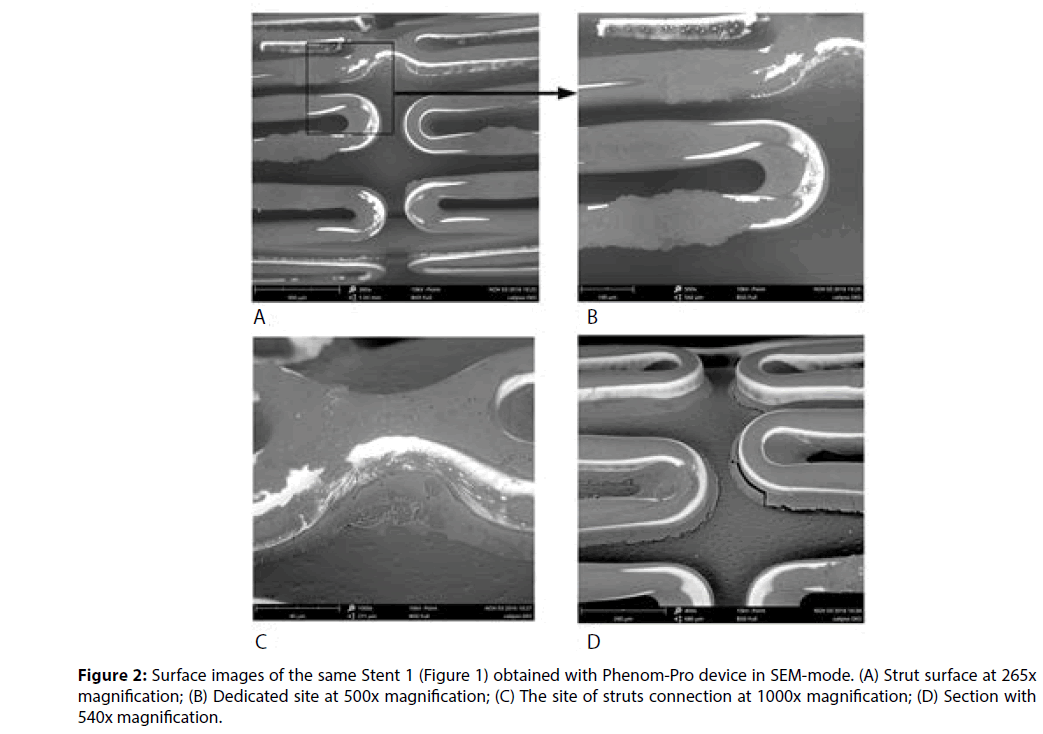 interventional-cardiology-Surface-images