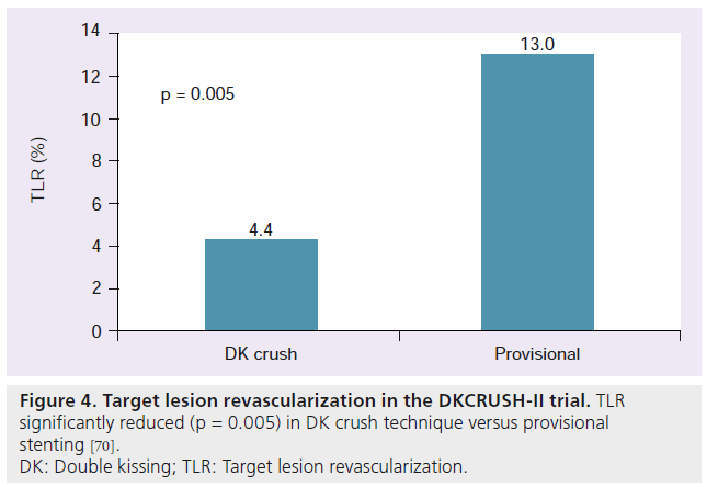 interventional-cardiology-Target-lesion