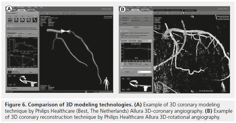 interventional-cardiology-angiography