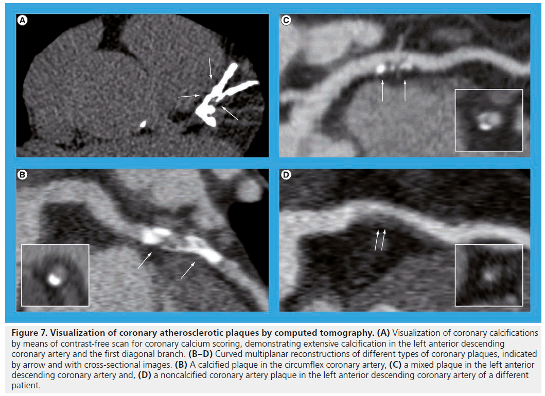 interventional-cardiology-anterior