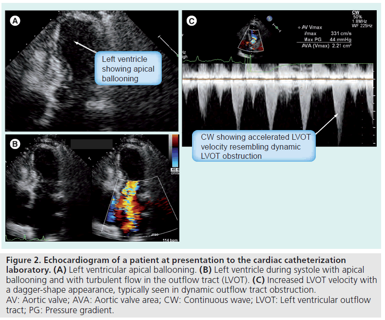 interventional-cardiology-cardiac